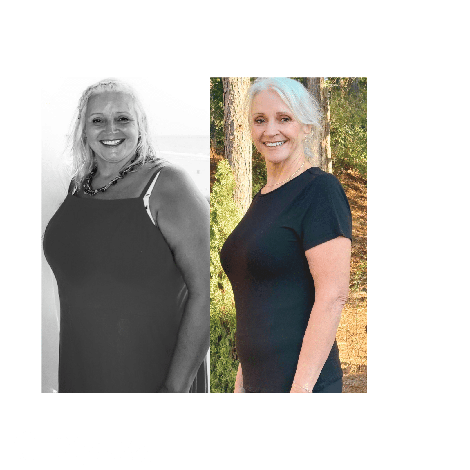 Before-and-after image showing Judy’s healthy weight loss and renewed confidence through Ageless Wellness Center’s medically guided GLP-1 program in Peachtree City, Georgia.
